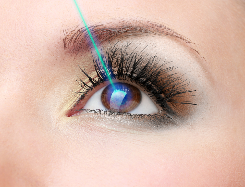 Laser,Vision,Correction.,Woman's,Eye.