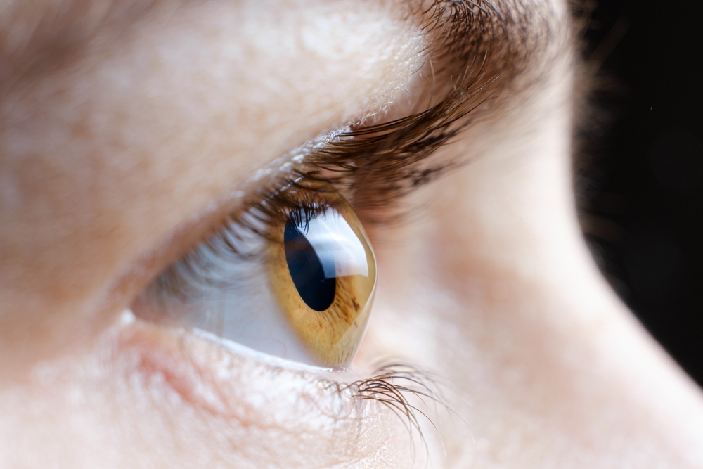 Macro,Photo,Of,The,Human,Eye,With,Corneal,Disease,Keratoconus