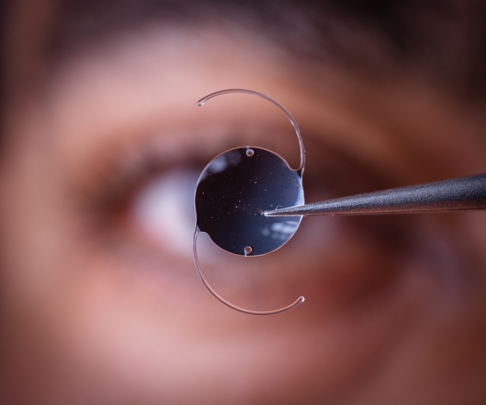 Photo,Of,Intra,Ocular,Lens,Iol,For,Treating,Cataract,Infront