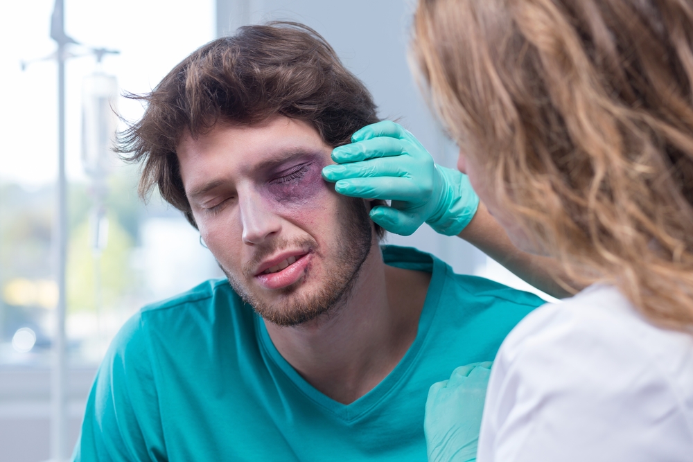 Portrait,Of,Male,Patient,With,Black,Eye