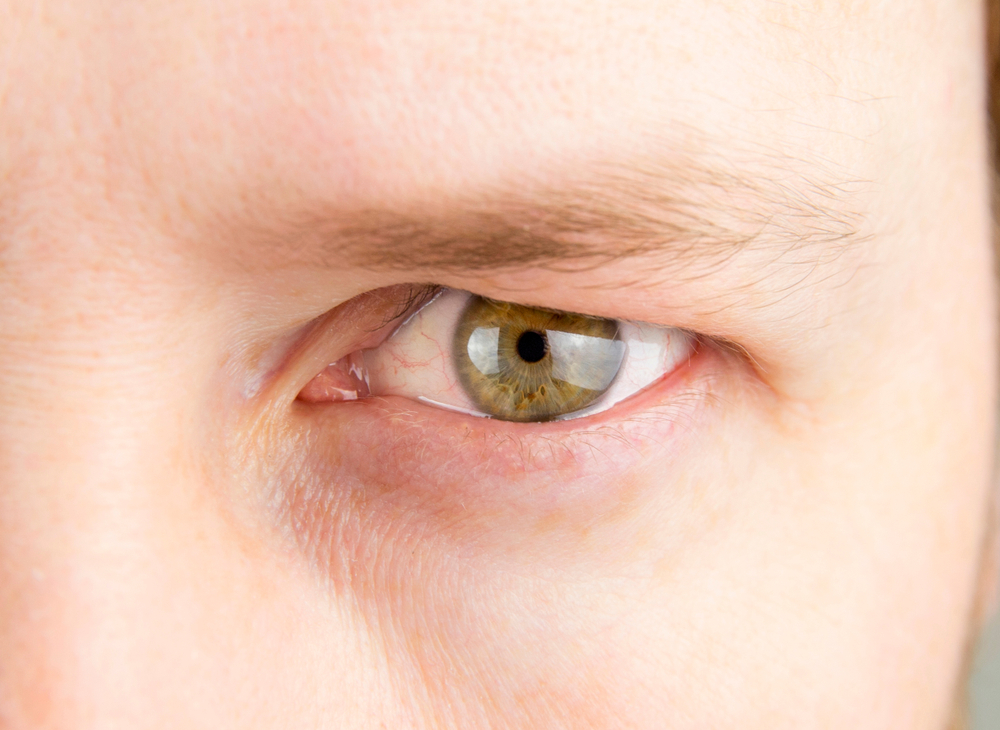 Detail,View,Of,Man,Green,Eye,With,Heavy,Upper,Eyelid.